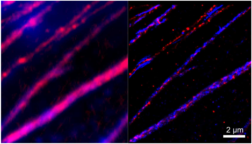 Fluoreszenzbild zeigt die höchstaufgelöste Kolokalisierung von Kollagen- und Pericardinfasern.