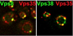 Zweikanalfluoreszenzbild zeigt die Verteilung endosomaler Proteine Vps8 und Vps35 relativ zueinander.